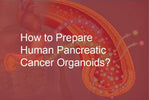 How to Prepare Human Pancreatic Cancer Organoids