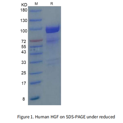 Recombinant Human HGF Protein, Flag Tag_C230226